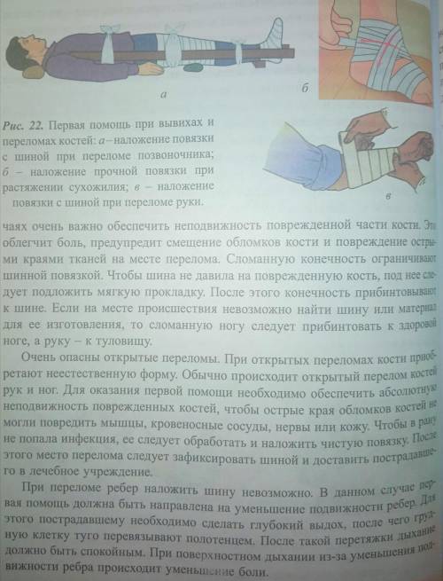 Обоснование правил при1)растяжение2)ударе3) вывихе4) переломе