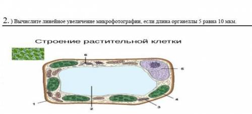 Вычислите линейное увеличение микрофотографии, если длина органеллы 5 равна 10 мкм.