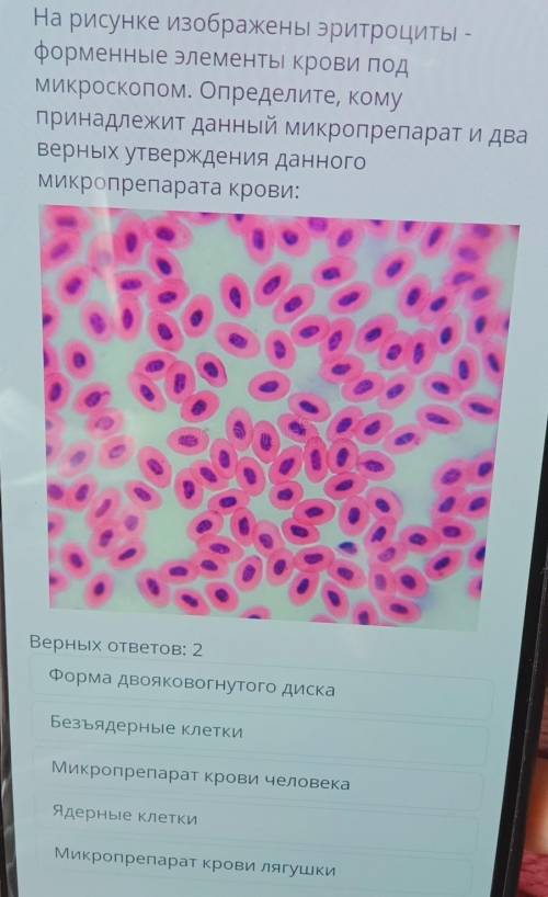На рисунке изображены эритроциты - форменные элементы крови подМикроскопом. Определите, комупринадле