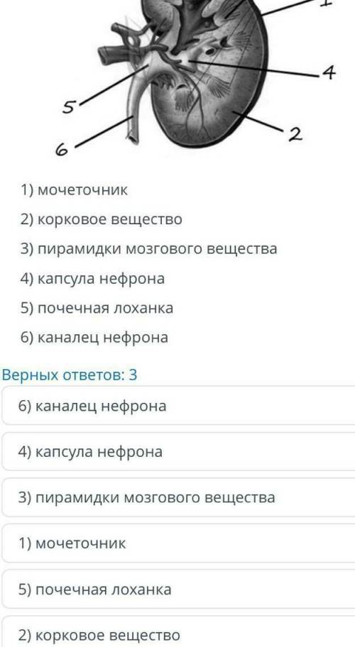 К рисунку Строение почки человека выберите три верно обозначенные подписи
